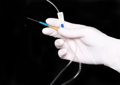 UV LIGHT CURABLE ADHESIVES FOR MEDICAL DEVICE ASSEMBLY